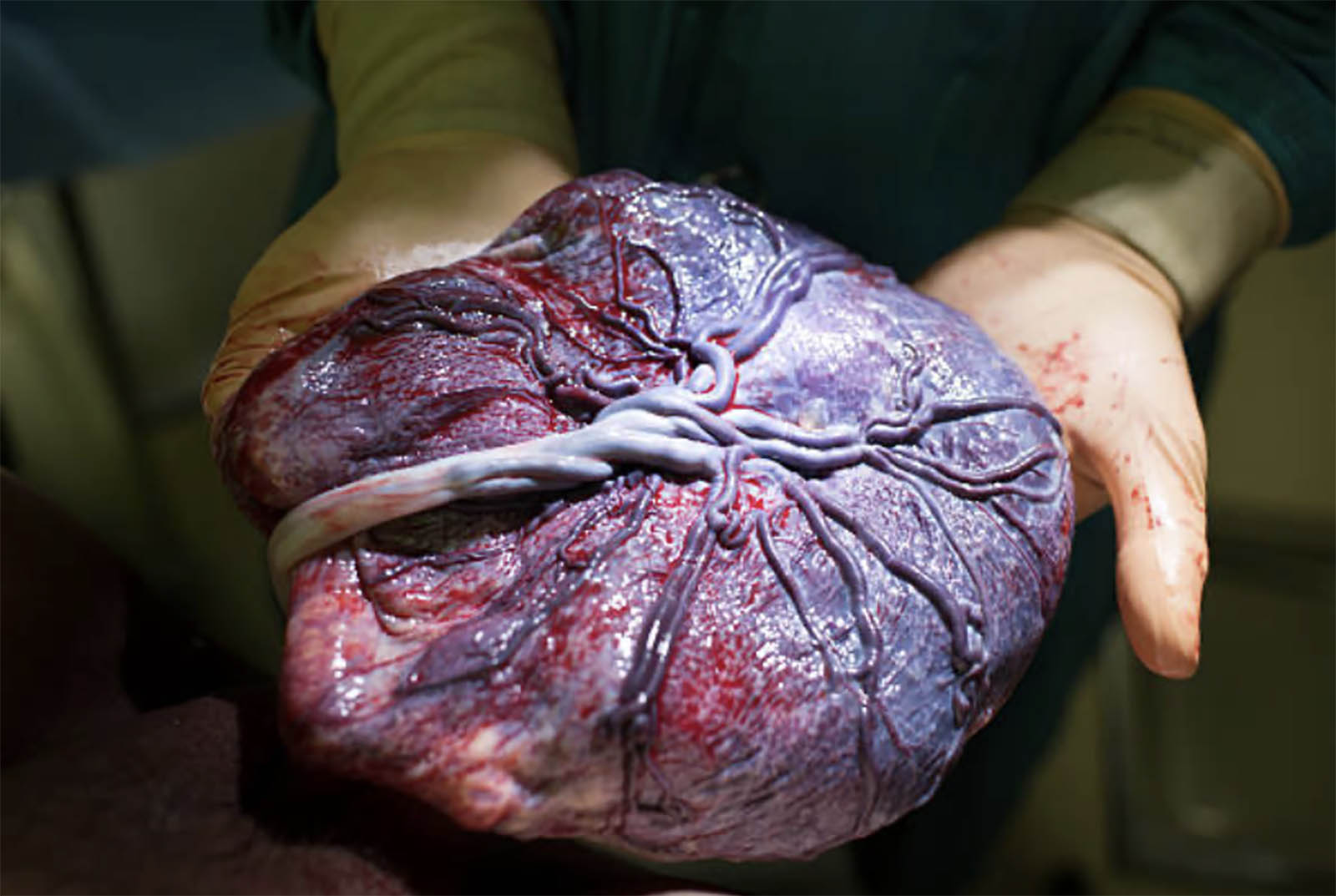 Placenta