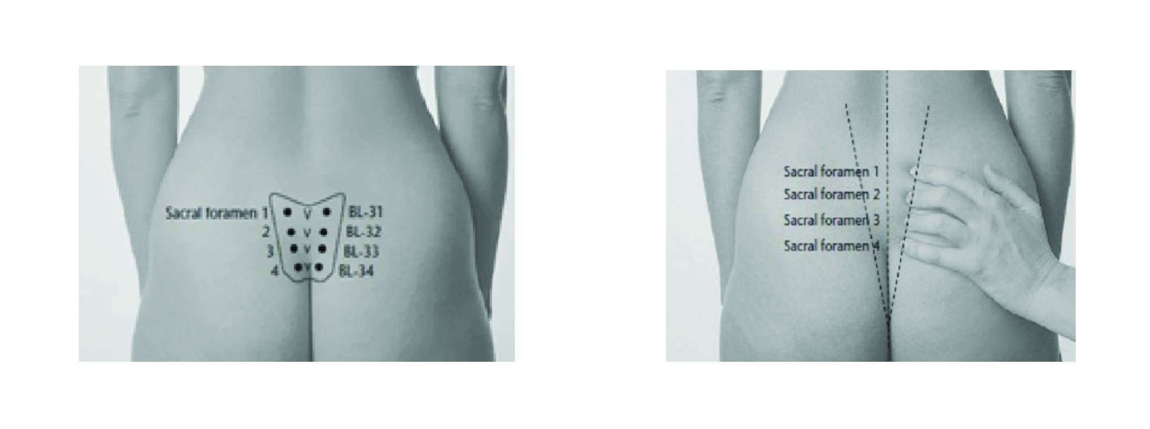 BL32 Acupressure Point for Labour